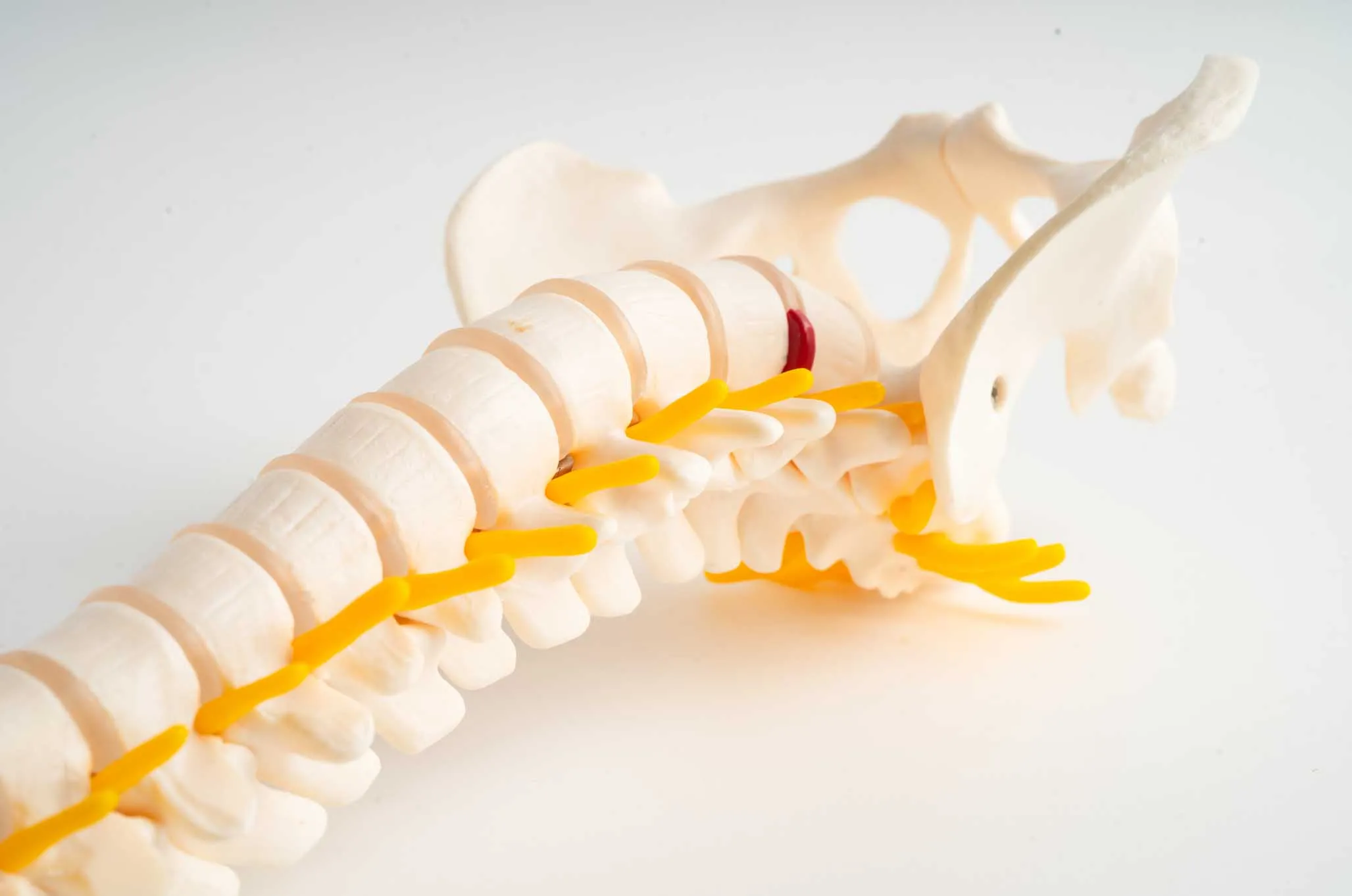 Herniated Disc Treatment by a Chiropractor