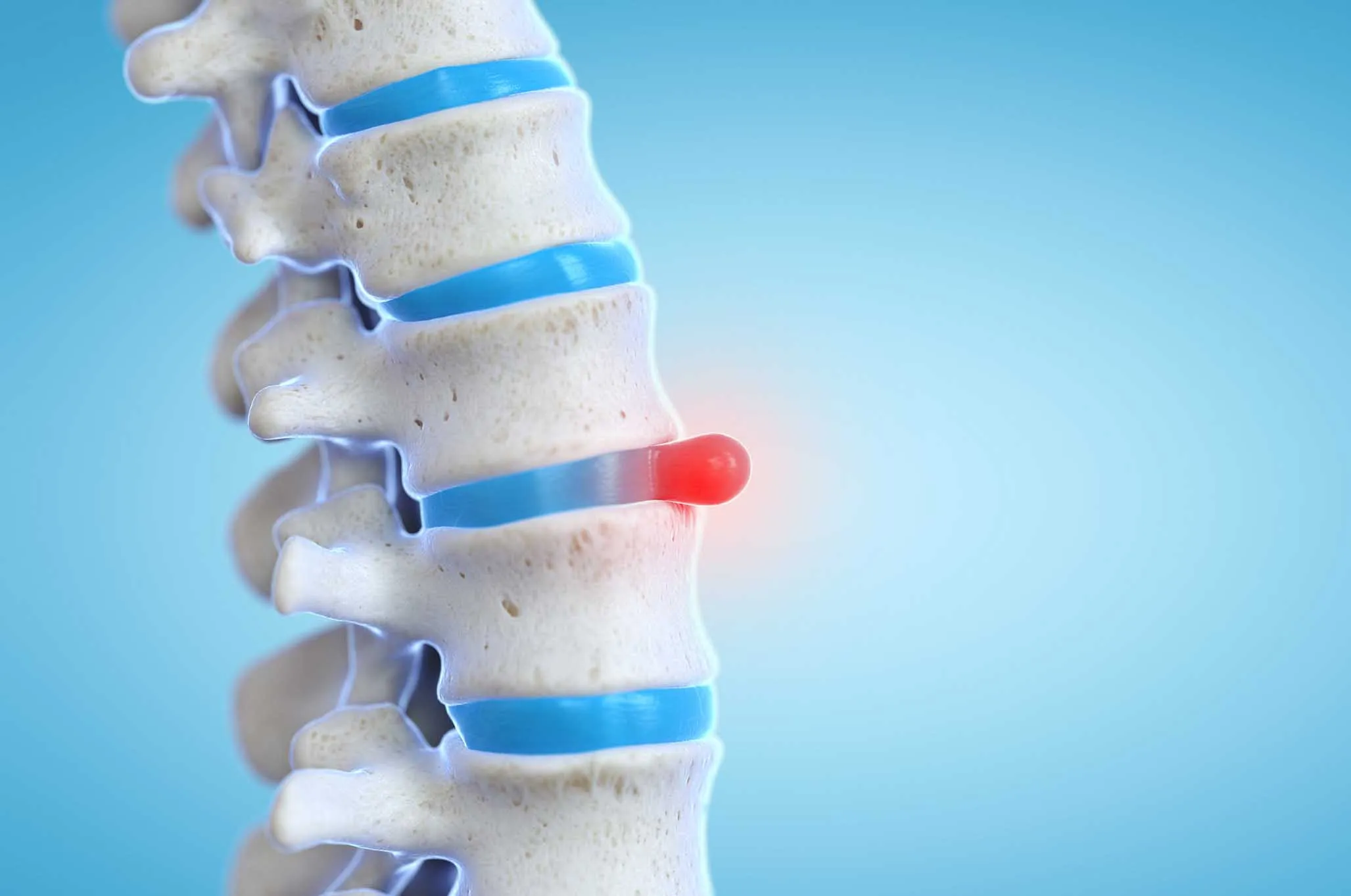 Spinal Decompression