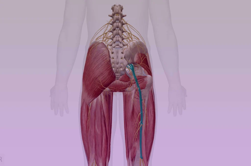 understanding sciatica